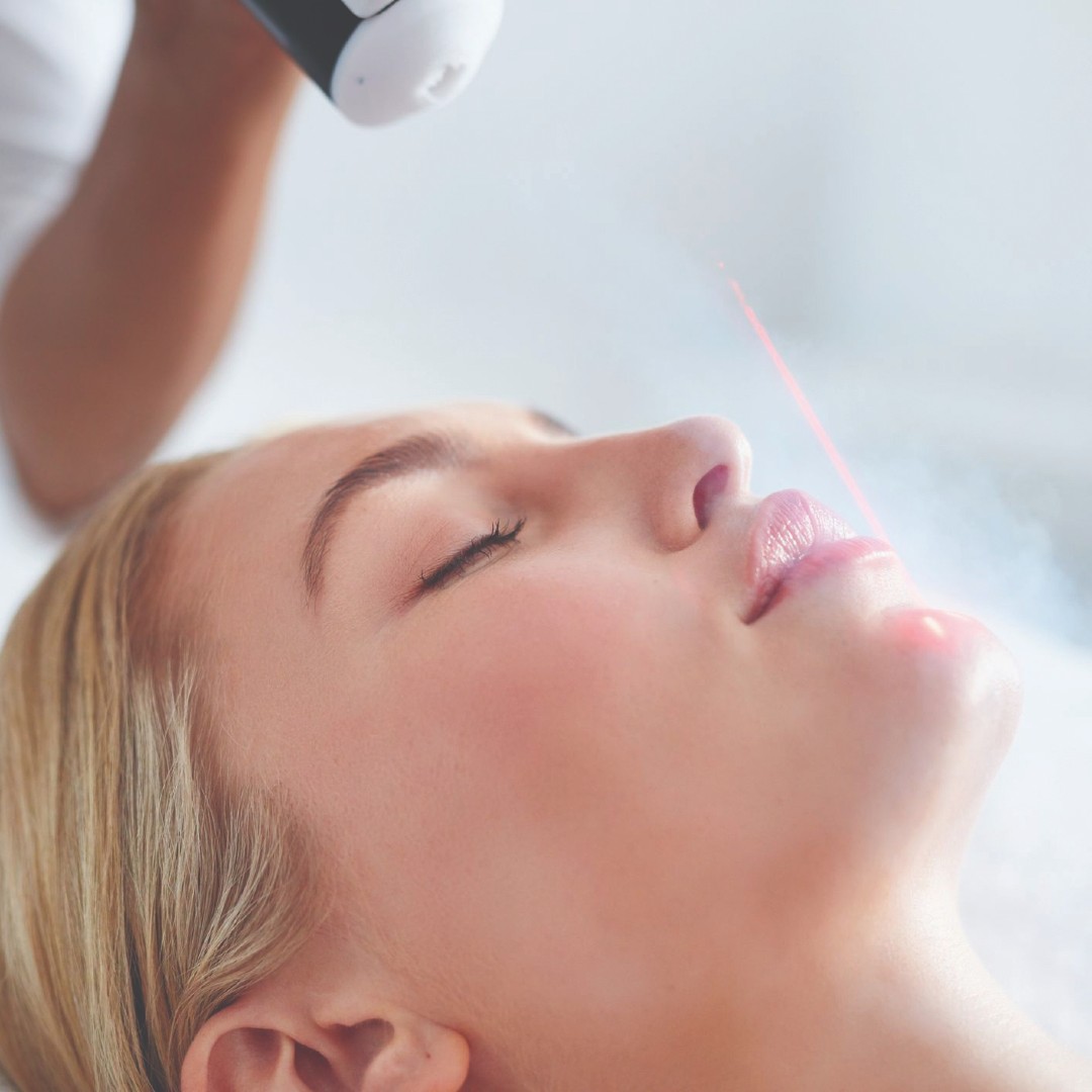 Crioterapia facială și expunerea la soare
