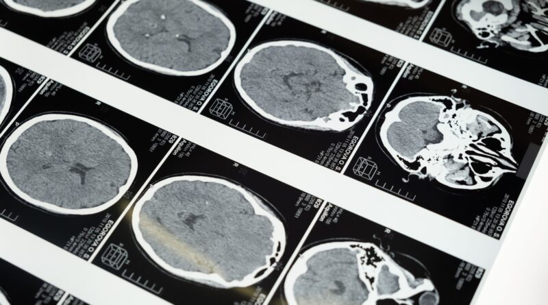 Viitorul sănătății creierului: de la dezvoltare la prevenție și intervenție clinică
