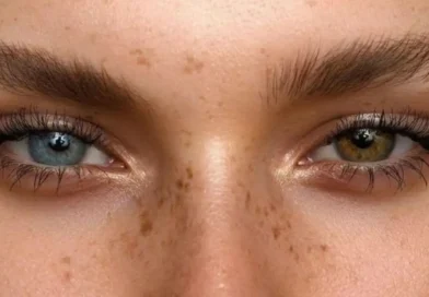 Heterocromia: de ce avem ochii de culori diferite și când trebuie să ne îngrijorăm?