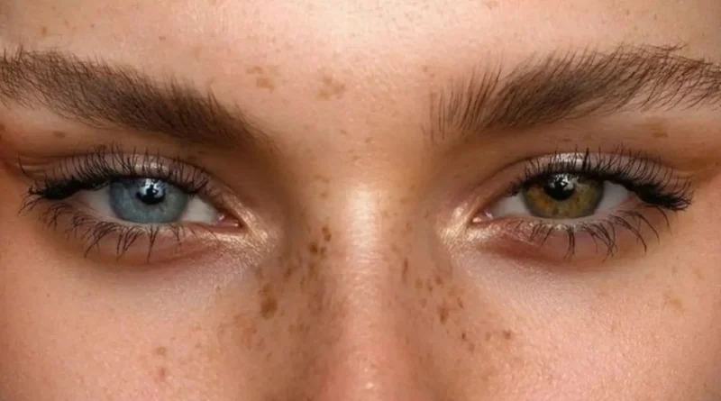 Heterocromia: de ce avem ochii de culori diferite și când trebuie să ne îngrijorăm?